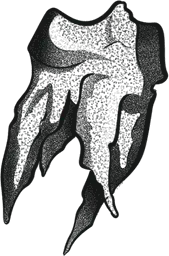Decaying Molar Tooth