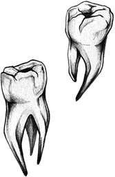 Damaged teeth